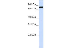 WB Suggested Anti-ZFYVE1 Antibody Titration:  0. (ZFYVE1 antibody  (C-Term))