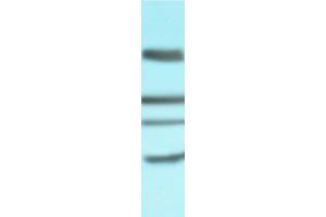 Western Blot using anti-CD4 antibody CE9. (Recombinant CD4 (Clenoliximab Biosimilar) antibody)