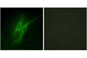 Immunofluorescence analysis of HeLa cells, using 5-HT-4 Antibody. (Serotonin Receptor 4 antibody  (AA 21-70))