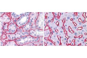 Anti collagen IV antibody (1:400, 45 min RT) showed strong staining in FFPE sections of human kidney (Left) with strong red staining observed in glomeruli and liver (Right) with strong staining in sinusoids. (Collagen IV antibody)