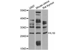 Western blot analysis of extracts of various cell lines, using IL1B antibody (ABIN5997974) at 1/1000 dilution. (IL-1 beta antibody)