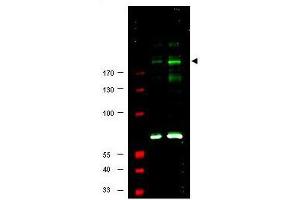 Image no. 1 for anti-Insulin Receptor Substrate 1 (IRS1) (pSer307) antibody (ABIN199910) (IRS1 antibody  (pSer307))