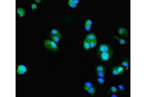 Immunofluorescent analysis of MCF-7 cells using ABIN7156025 at dilution of 1:100 and Alexa Fluor 488-congugated AffiniPure Goat Anti-Rabbit IgG(H+L) (HIF1AN antibody  (AA 2-254))