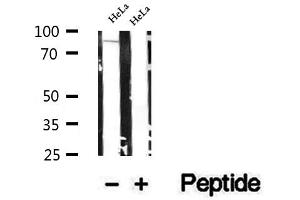Western blot analysis of extracts of HeLa cells, using SEC6 antibody. (EXOC3 antibody  (Internal Region))