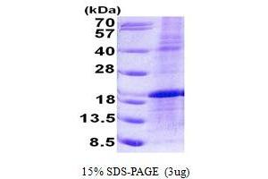 SDS-PAGE (SDS) image for LIM Domain Only 1 (Rhombotin 1) (LMO1) (AA 1-156) protein (His tag) (ABIN6387185) (LMO1 Protein (AA 1-156) (His tag))