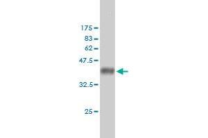 Western Blotting (WB) image for anti-Androgen Receptor (AR) (AA 221-320) antibody (ABIN559913)