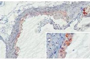 Immunohistochemistry (IHC) image for anti-Mannan Binding Protein/Mannan Binding Lectin (MBP/MBL) antibody (ABIN1108115) (MBP/MBL antibody)