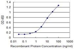Detection limit for recombinant GST tagged SMO is 0. (SMO antibody  (AA 653-787))