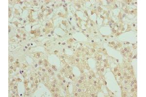 Immunohistochemistry of paraffin-embedded human adrenal gland tissue using ABIN7168234 at dilution of 1:100 (RING1 antibody  (AA 401-630))
