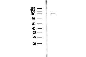 anti-Ankyrin Repeat Domain 20 Family, Member A1 (ANKRD20A1) (N-Term) antibody