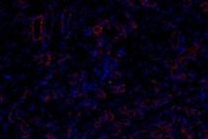 Immunofluorescentanalysis of paraformaldehyde-fixedratkidneyusing,Claudin 10 (ABIN7073514) at dilution of 1:800 (CLDN10 antibody)