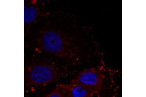 Immunofluorescence staining of methanol-fixed HeLa cells using PXN (phospho Y88) polyclonal antibody (Cat # PAB25910, red). (Paxillin antibody  (pTyr88))