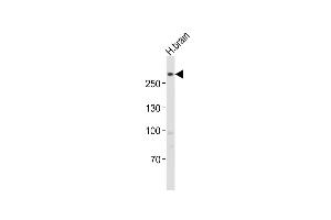 Anti-LRRK2 Antibody (C-term) at 1:1000 dilution + human brain lysates Lysates/proteins at 20 μg per lane. (LRRK2 antibody  (C-Term))
