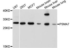 Western blot analysis of extracts of various cell lines, using PSMA7 antibody. (PSMA7 antibody)