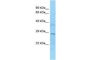 WB Suggested Anti-SMN2 Antibody Titration: 1. (SMN2 antibody  (N-Term))