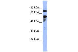 WB Suggested Anti-ZNF549  Antibody Titration: 0. (ZNF549 antibody  (Middle Region))