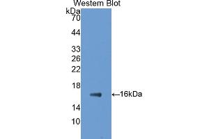 Western blot analysis of the recombinant protein. (GAD antibody  (AA 1-97))