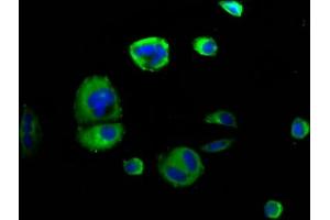 Immunofluorescence staining of MCF-7 cells with ABIN7168803 at 1:166, counter-stained with DAPI. (SEMA4D/CD100 antibody  (AA 756-862))