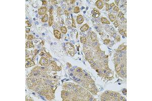 Immunohistochemistry of paraffin-embedded human stomach using TRPA1 antibody (ABIN5996346) at dilution of 1/100 (40x lens). (TRPA1 antibody)