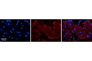 Rabbit Anti-AKAP7 Antibody    Formalin Fixed Paraffin Embedded Tissue: Human Adult heart  Observed Staining: Membrane Primary Antibody Concentration: 1:600 Secondary Antibody: Donkey anti-Rabbit-Cy2/3 Secondary Antibody Concentration: 1:200 Magnification: 20X Exposure Time: 0. (AKAP7 antibody  (N-Term))