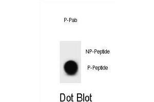 Dot blot analysis of bcl-2 Antibody (Phospho T56) Phospho-specific Pab (ABIN1881106 and ABIN2839946) on nitrocellulose membrane.