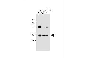 All lanes : Anti-BCKDHB Antibody (N-term) at 1:1000 dilution Lane 1: Hela whole cell lysate Lane 2: 293T/17 whole cell lysate Lane 3: Jurkat whole cell lysate Lysates/proteins at 20 μg per lane.