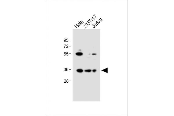 BCKDHB antibody  (N-Term)