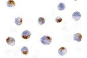 Immunohistochemistry (IHC) image for anti-Apoptotic Chromatin Condensation Inducer 1 (ACIN1) (Middle Region) antibody (ABIN1030843) (ACIN1 antibody  (Middle Region))