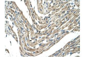 FBXL5 antibody was used for immunohistochemistry at a concentration of 4-8 ug/ml to stain Skeletal muscle cells (arrows) in Human Muscle. (FBXL5 antibody  (Middle Region))