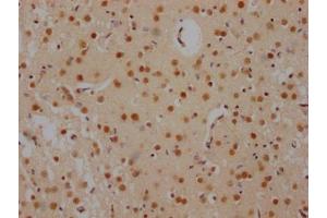 IHC image of ABIN7127503 diluted at 1:100 and staining in paraffin-embedded human brain tissue performed on a Leica BondTM system. (Recombinant FUBP1 antibody)