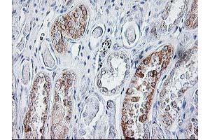 Immunohistochemical staining of paraffin-embedded Human Kidney tissue using anti-SIRT5 mouse monoclonal antibody. (SIRT5 antibody)