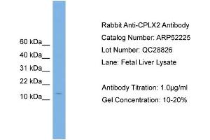 WB Suggested Anti-CPLX2  Antibody Titration: 0. (CPLX2 antibody  (N-Term))