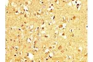 IHC image of ABIN7166420 diluted at 1:200 and staining in paraffin-embedded human brain tissue performed on a Leica BondTM system. (PCMT1 antibody  (AA 117-228))