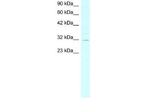 WB Suggested Anti-ASGR2 Antibody Titration:  4. (Asialoglycoprotein Receptor 2 antibody  (N-Term))