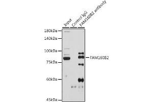 Immunoprecipitation analysis of 600 μg extracts of Rat testis cells using 3 μg FB2 antibody (ABIN7267111). (FAM160B2 antibody)