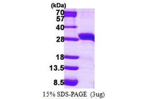 SDS-PAGE (SDS) image for Steroidogenic Acute Regulatory Protein (STAR) (AA 64-285) protein (His tag) (ABIN667607)
