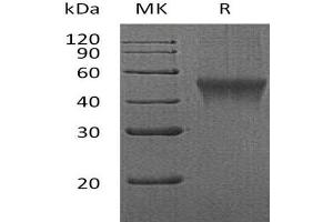 FCRL1 Protein (AA 17-219) (His tag)