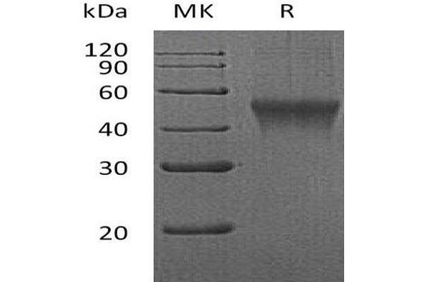 FCRL1 Protein (AA 17-219) (His tag)