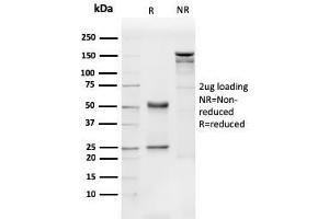 SDS-PAGE Analysis Purified CD31 Mouse Monoclonal Antibody (PECAM1/3540).