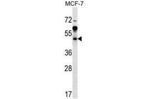 ARFIP1 Antibody (Center) western blot analysis in MCF-7 cell line lysates (35µg/lane). (ARFIP1 antibody  (Middle Region))