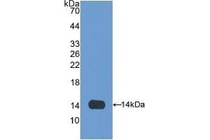 Detection of Recombinant OLFM4, Rat using Polyclonal Antibody to Olfactomedin 4 (OLFM4) (Olfactomedin 4 antibody  (AA 405-511))