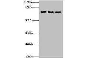Western blot All lanes: ZNF699 antibody at 2 μg/mL Lane 1: Jurkat whole cell lysate Lane 2: K562 whole cell lysate Lane 3: U87 whole cell lysate Secondary Goat polyclonal to rabbit IgG at 1/10000 dilution Predicted band size: 74 kDa Observed band size: 74 kDa (ZNF699 antibody  (AA 19-195))