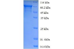 SDS-PAGE (SDS) image for Iduronidase, alpha-L- (IDUA) (AA 28-653) protein (His tag) (ABIN5709707) (IDUA Protein (AA 28-653) (His tag))