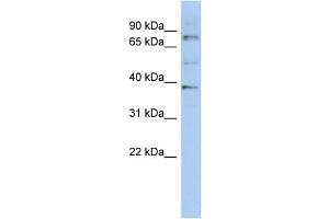 WB Suggested Anti-OAS2 Antibody Titration:  0. (OAS2 antibody  (N-Term))