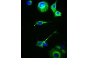 Immunofluorescence staining of MCF-7 cells with ABIN7159217 at 1:100, counter-stained with DAPI. (MC5 Receptor antibody  (AA 1-37))