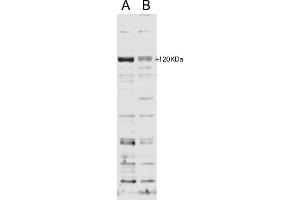 ABIN185714 staining of HFF cell lysate with B) 100nM siRNA or A) control siRNA. (SECISBP2 antibody  (Internal Region))