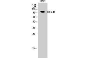 Western Blotting (WB) image for anti-Leucine Rich Repeat Containing 41 (LRRC41) (Internal Region) antibody (ABIN3185414) (LRRC41 antibody  (Internal Region))