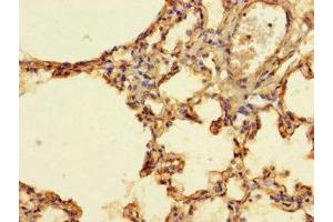Immunohistochemistry of paraffin-embedded human lung tissue using ABIN7156574 at dilution of 1:100 (IFI27L2 antibody  (AA 87-130))