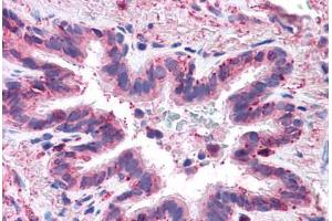 Human Lung, Respiratory Epithelium: Formalin-Fixed, Paraffin-Embedded (FFPE) (MFI2 antibody  (N-Term))