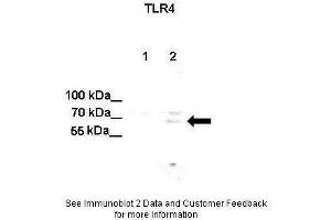 Lanes:  Lane 1: Untreated human U251 cell lysate Lane 2: IL-1beta treated human U251 cell lysate Primary Antibody Dilution:  1:500 Secondary Antibody:  Anti-rabbit-HRP Secondary Antibody Dilution:  1:500 Gene Name:  TLR4 Submitted by:  Anonymous (TLR4 antibody  (C-Term))